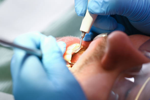 Best Emergency Broken Tooth Repair in Waterloo, NE