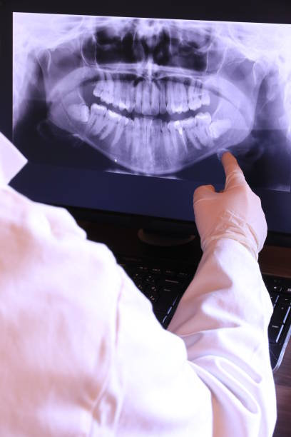 Best Emergency Tooth Extraction in Waterloo, NE